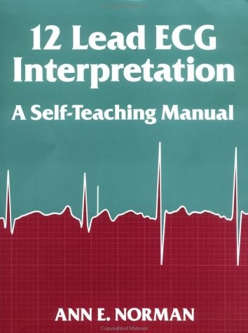 Lead ecg interpretation a - 12-lead, interpretation: